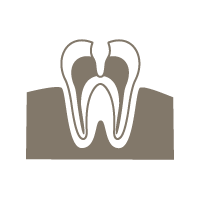 根管治療（歯内療法）