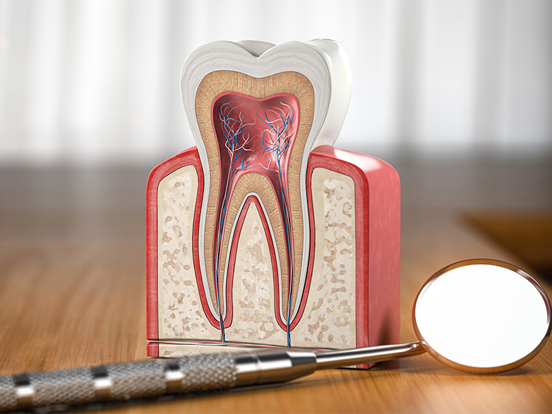根管治療（歯内療法）